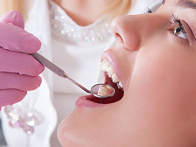 A woman receiving dental treatment with a dental drill being used on her teeth by a professional in a dental office setting.