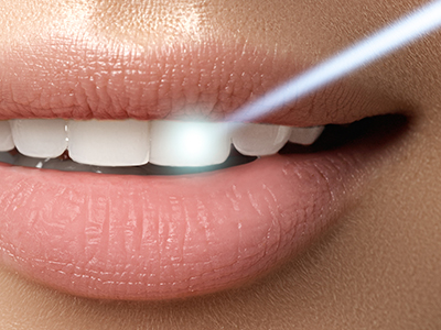 The image shows a close-up view of a person s lips with a focus on the teeth, which are highlighted by a bright light source.